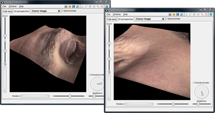 Antera 3D - Analisi cutanea in tre dimensioni
