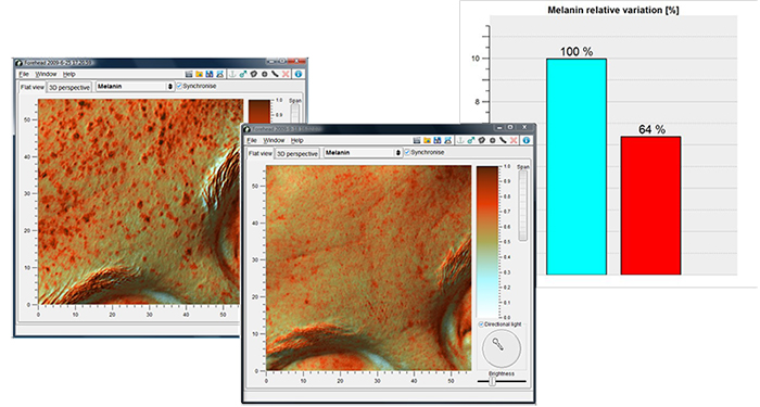 Antera 3D: misura della melanina