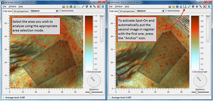Antera 3D- Spot-On registro automatico delle immagini