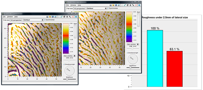 Antera 3D - analisi della trama cutanea