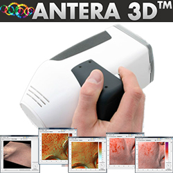 Antera 3D