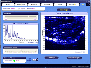 Modulo 2D del Software dell'Adipometro Bodymetrix  BX2000 : una misura di precisione della struttura e delle variazioni del tessuto adiposo
Click per ingrandire