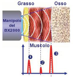 Adipometro Bodymetrix: anatomia e ultrasuoni