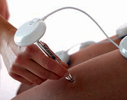 Compex Wireless Professional: posizionamento degli elettrodi estremamente preciso