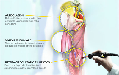 Hilterapia: effetti su arto inferiore