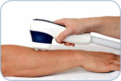 Mediostar Next MED: tecnologia laser di ultima generazione per l'epilazione. Massima efficacia, velocit, sucurezza nei trattamenti.